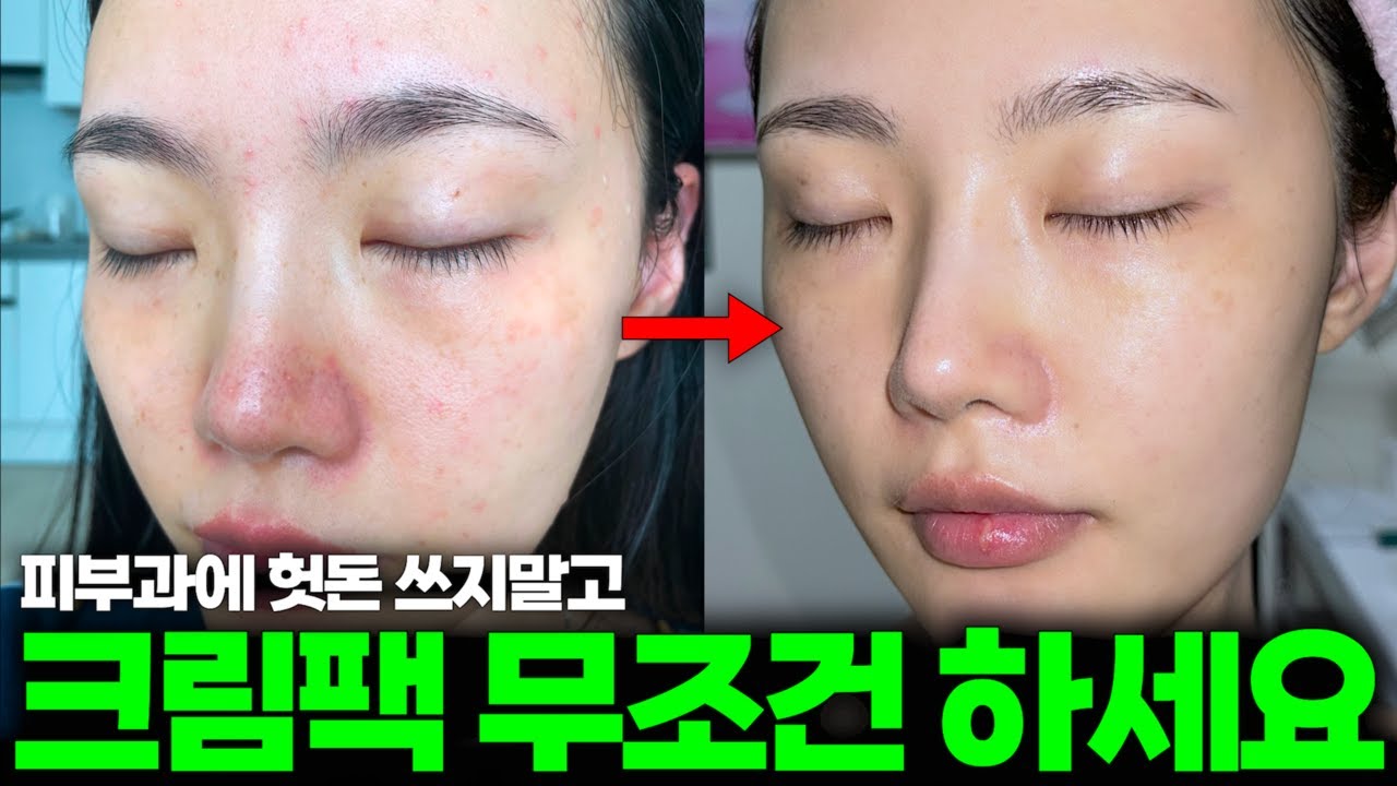 집에 수분크림이 있다면 무조건 클릭하세요 | 피부 좋은사람은 이것저것 많이 안해요