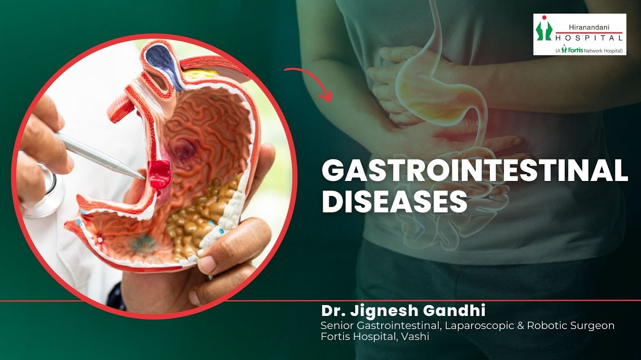 Gastrointestinal Diseases | Gall Bladder | Hernia | Appendix Pain| General Surgery| GI Disorders|VAS