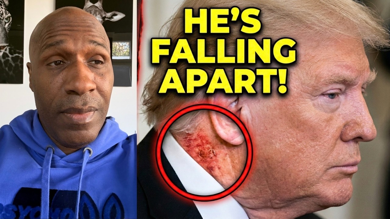 Nasty New Rash Seen on Trump's Neck Sparks 