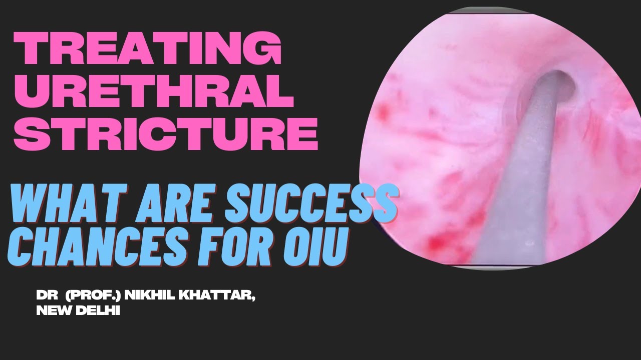What are the success rates for OIU in my Stricture?