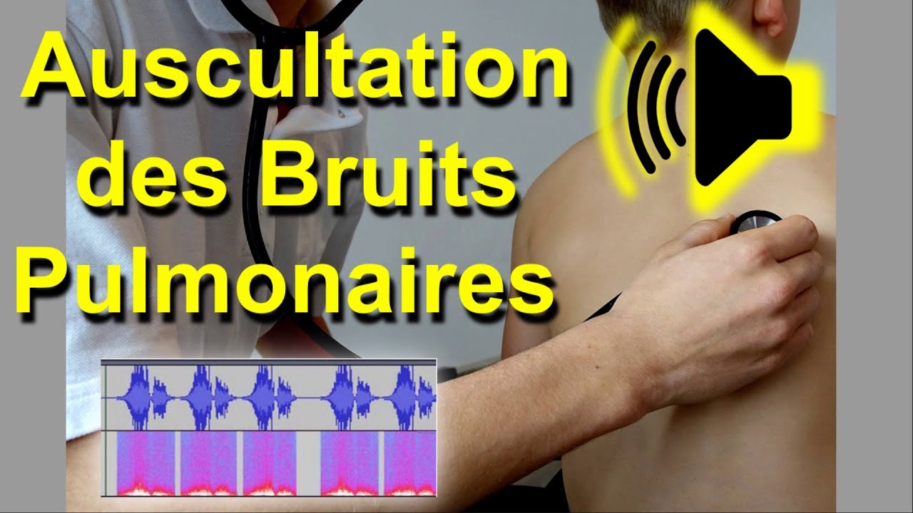 Bruits pulmonaires anormaux Auscultation Son Audio Poumon murmure vésiculaire frottement pleural