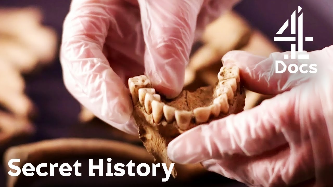 Black Deaths Victim's Teeth Analysis Reveals Shocking Results | Secret History