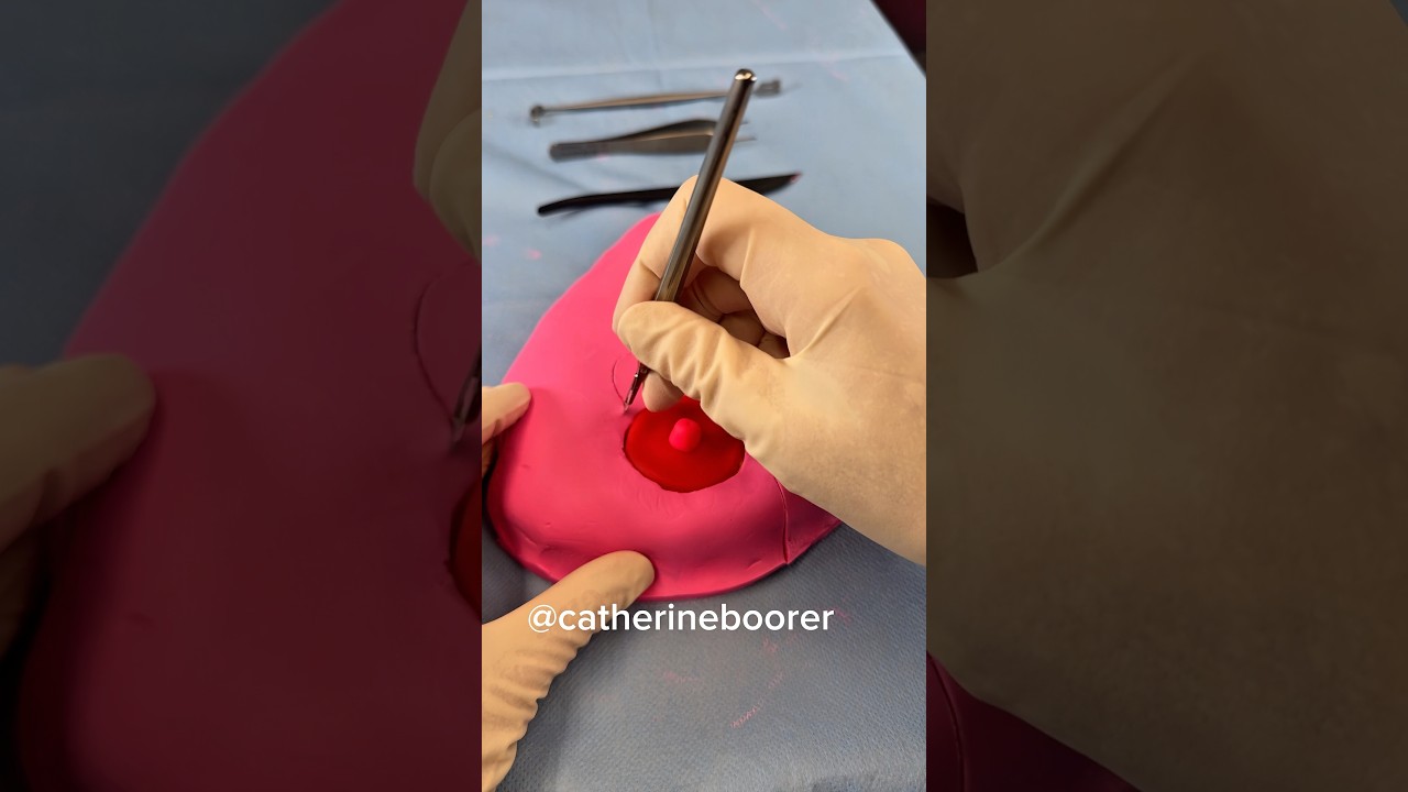 Plastic Surgeon demonstrates Breast Lift Surgery using Play-Doh
