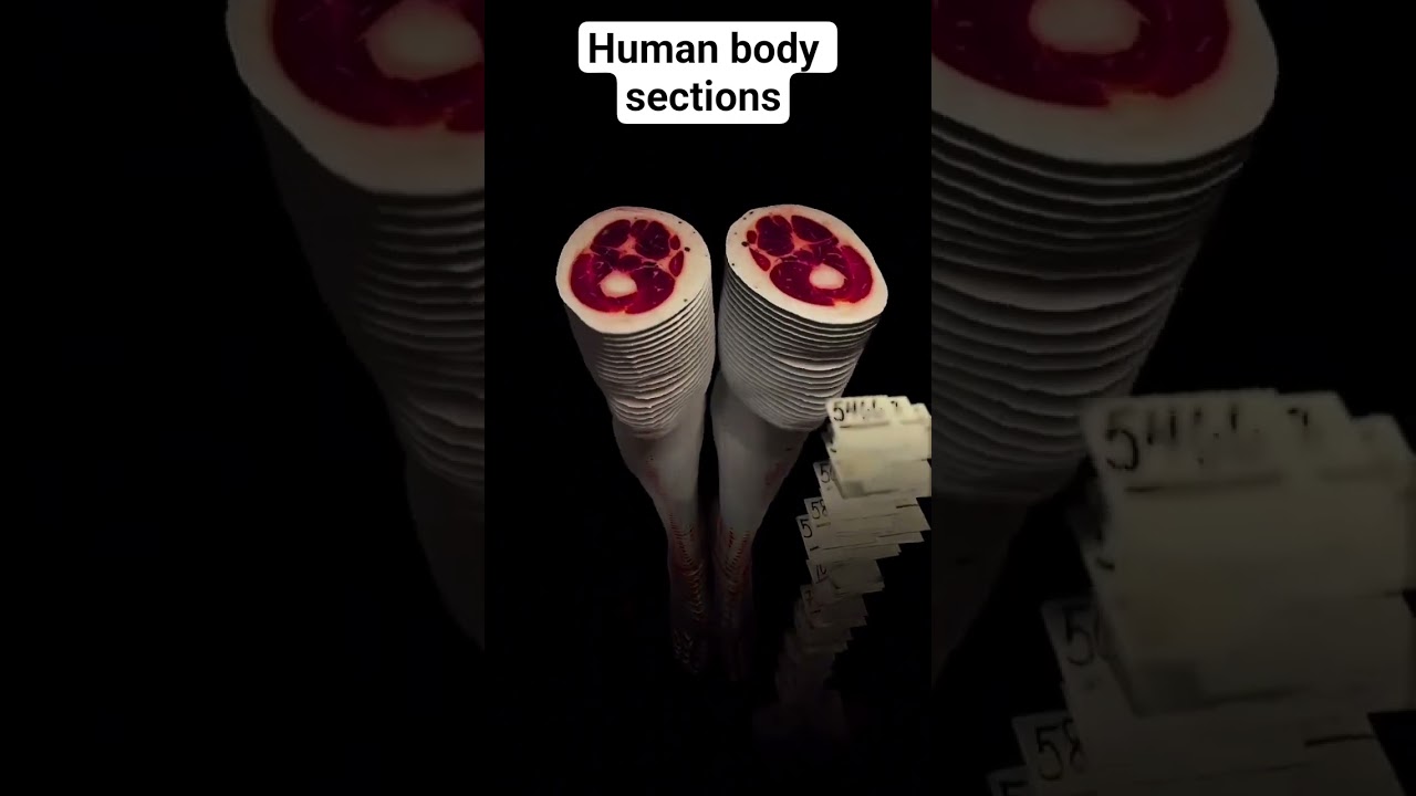 human body is amazing... MRI VIEW OF HUMAN BODY..ANATOMY IS WILD..#shortvideo #anatomy #learning