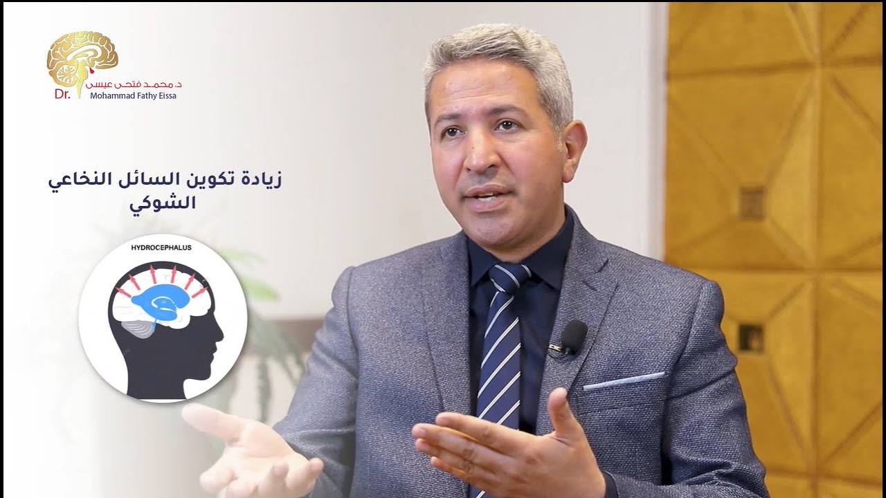 علاج استسقاء المخ بالمنظار