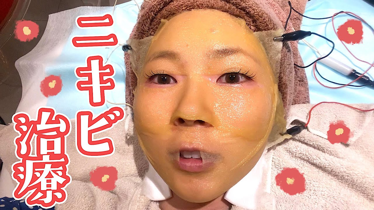 ニキビが憎くて許せないので息の根を止めてやる。