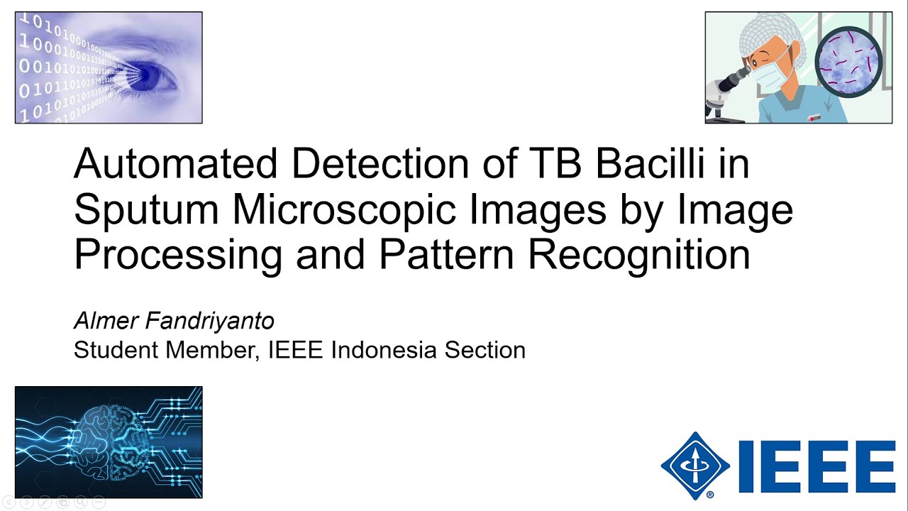 Almer Fandriyanto_Telkom University_Automated Detection of TB Bacilli in Sputum Microscopic Images