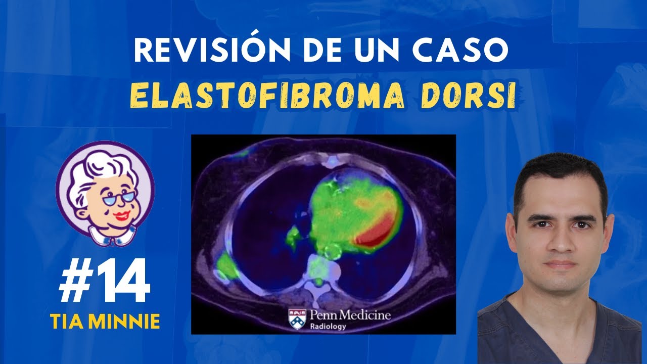 EL RADIÓLOGO EXPLICA / TOMOGRAFÍA Y PET-CT / TÍA MINNIE #14