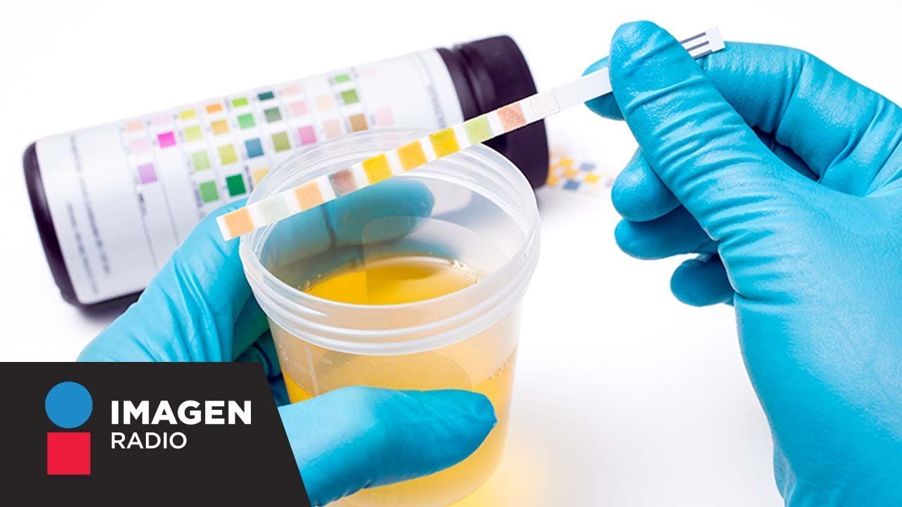 Dutch, la prueba hormonal más informativa / Bien y Saludable