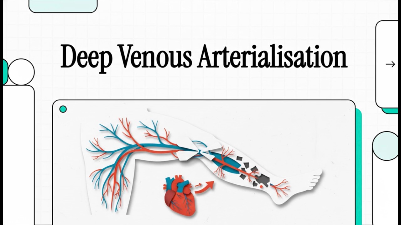 MET - 12 - Deep Venous Arterialisation - Explainer Video