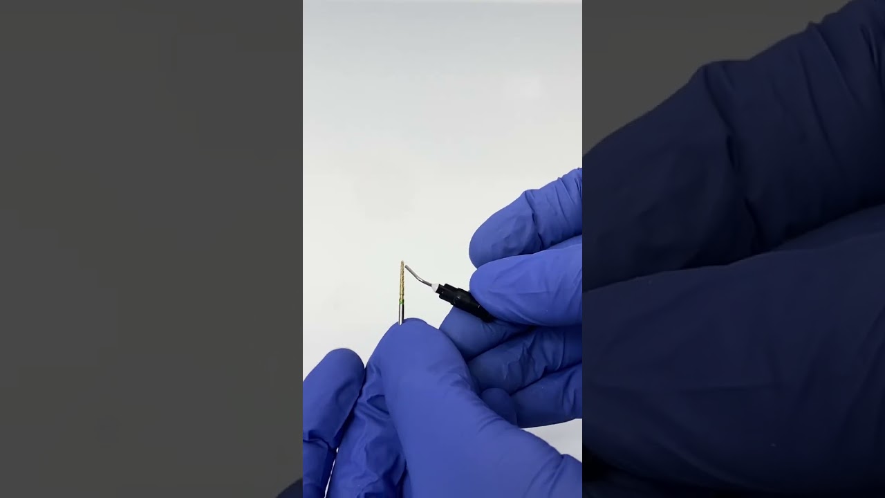 Modified Tube Technique for Broken File Removal | Advanced Endodontics | Retrieval | Retreatment RCT