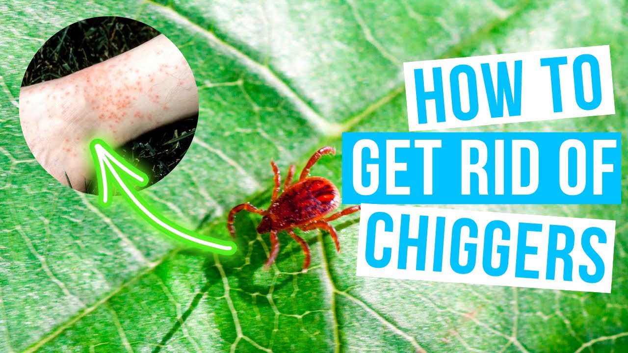 How to GET RID OF CHIGGERS in home and yard