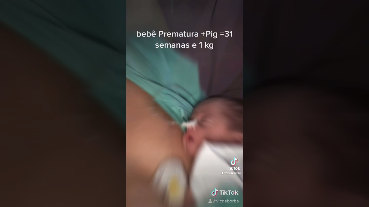 Beb&ecirc; Prematura 1 kg