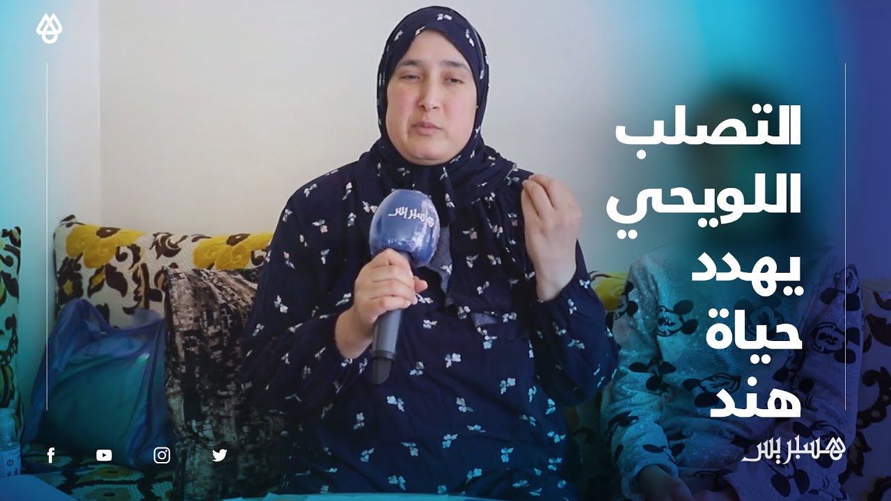 التصلب اللويحي.. مرض نادر أصاب 