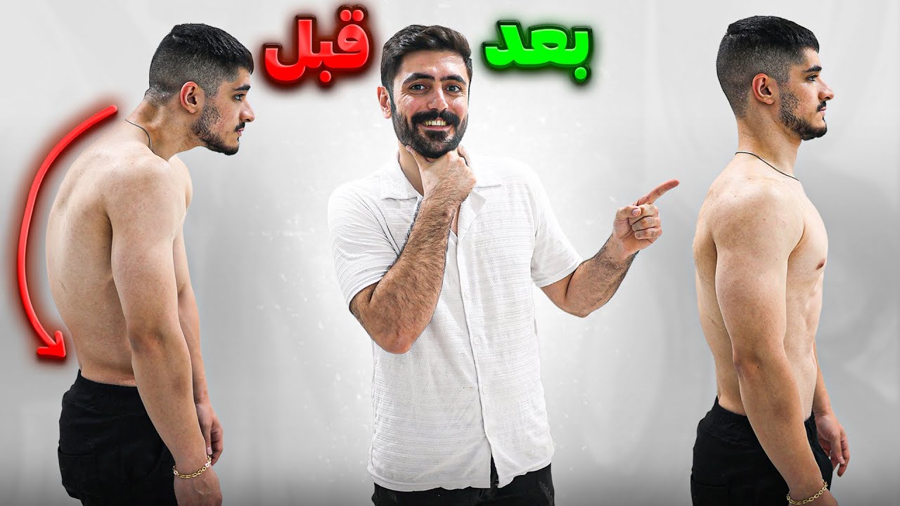آموزش درمان قوز کمر توی خونه (بر اساس علم پزشکی)