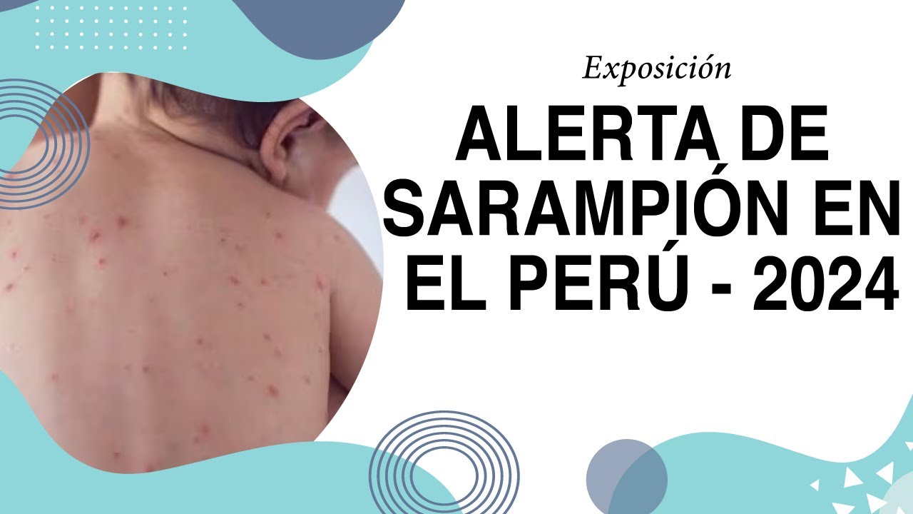ALERTA DE SARAMPIÓN EN EL PERÚ 2024