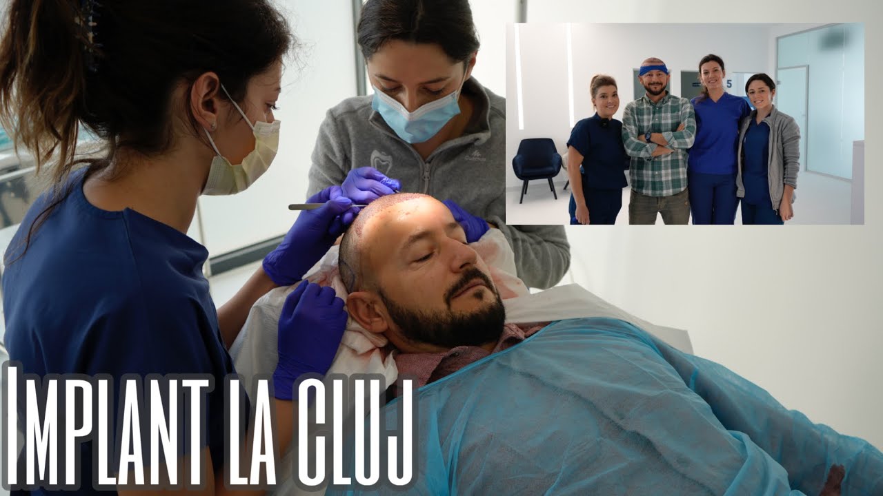 MI-AM FACUT IMPLANT DE PAR IN CLUJ!! DE CE NU IN TURCIA??