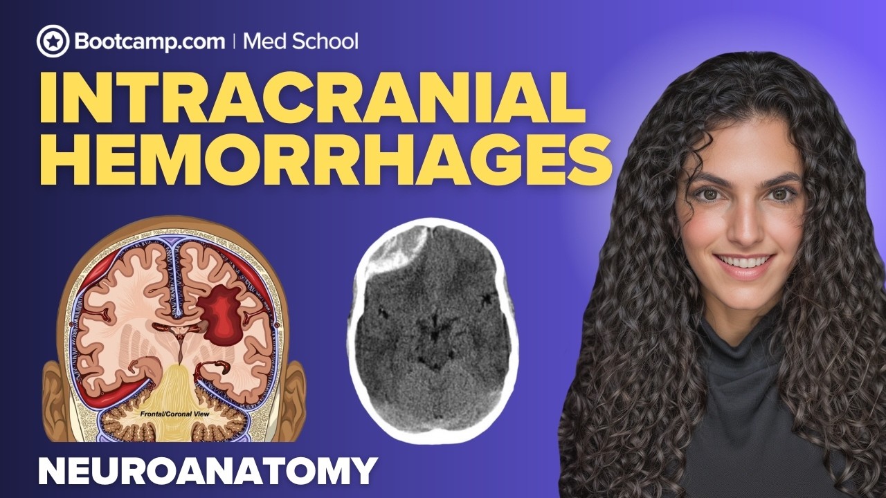 Intracranial Hemorrhage Overview | Epidural, Subdural, Subarachnoid & Intracerebral hemorrhage
