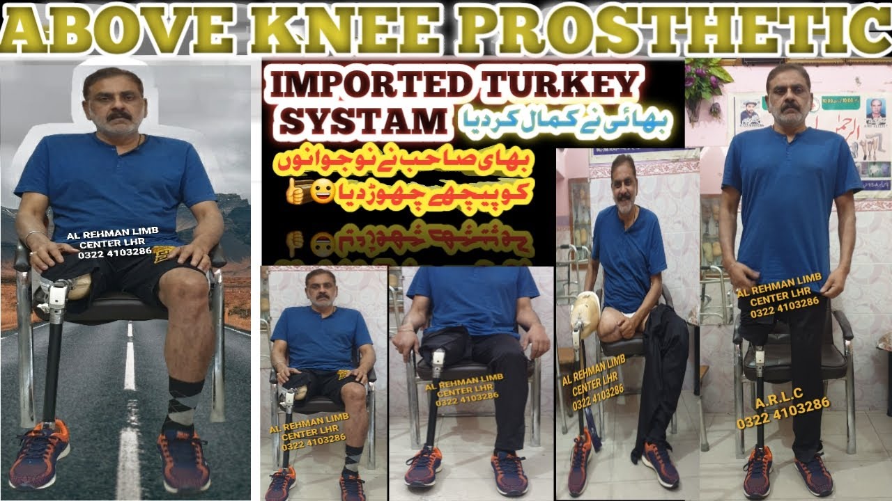 Above knee prosthesis leg imported Turkey systam #ottobock #prosthetics #artificial #leg #limb #pk