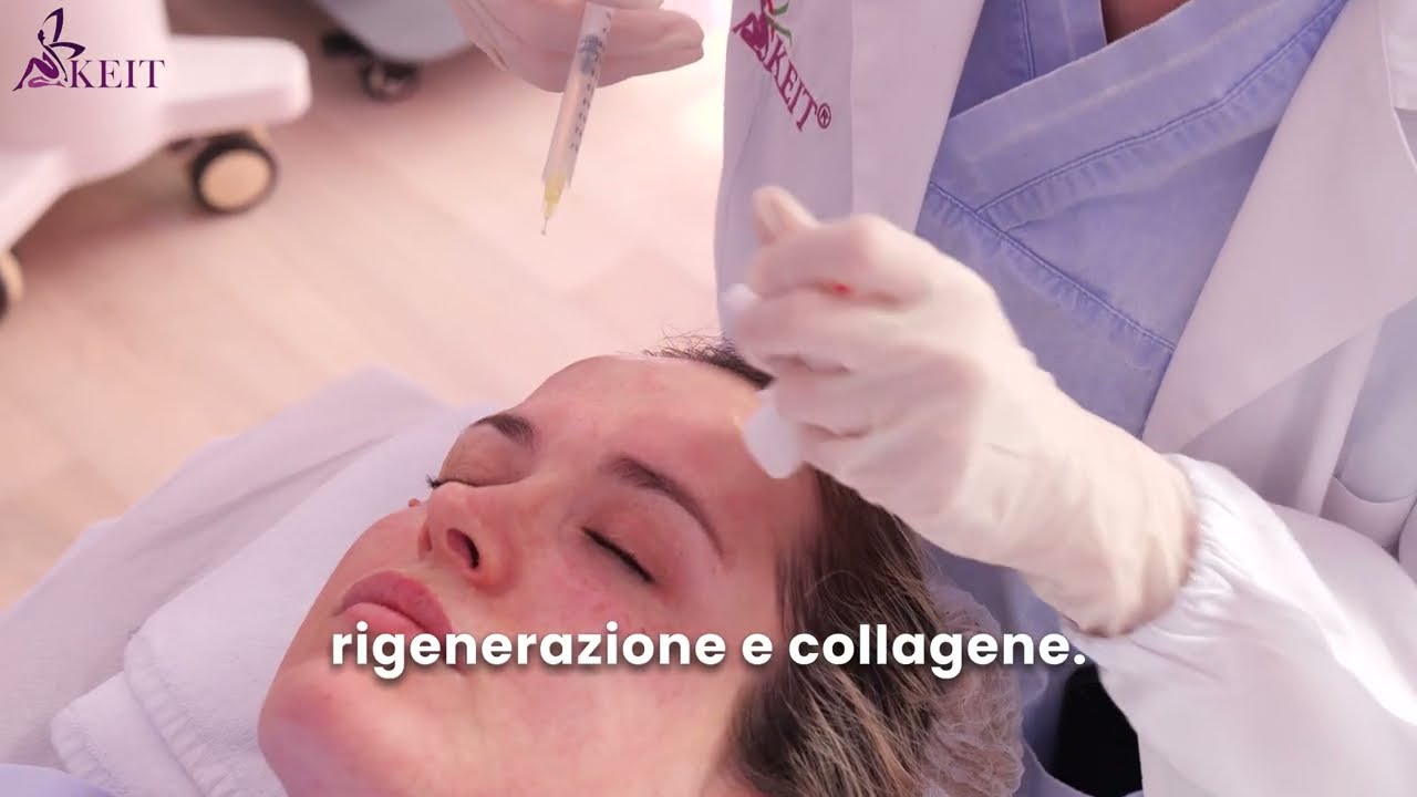 PRP Viso: Plasma Ricco di Piastrine, Benefici, Durata e Differenze con le Vitamine