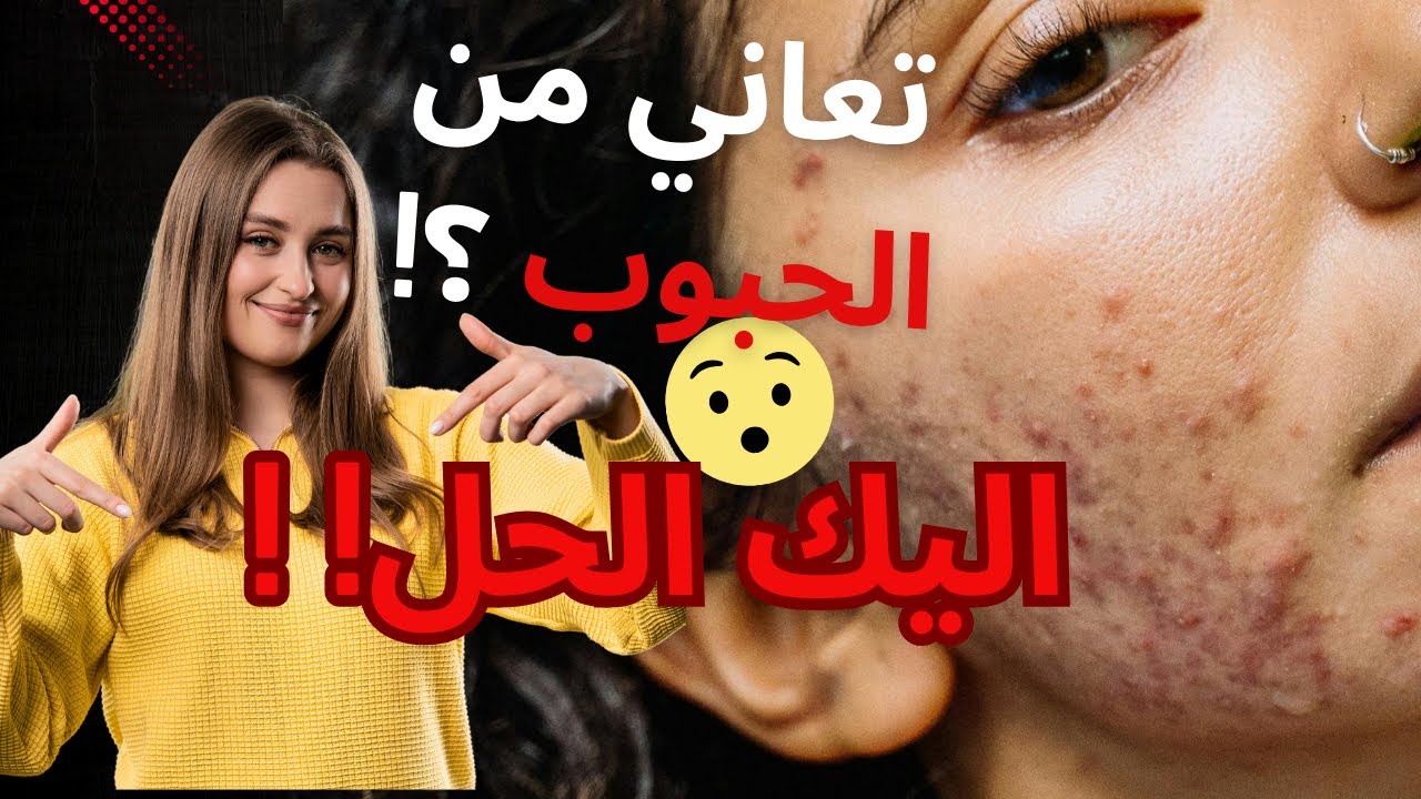 لماذا يعود #حب_ الشباب بعد الصيف؟ أسباب صادمة ونصائح لمنع عودته