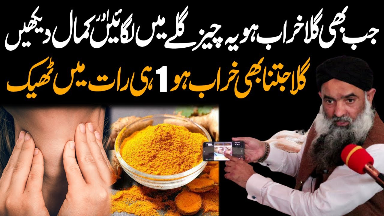 Tonsils ka elaj | Glay ki Kharabi ka elaj | Dr Sharafat Ali | Ahsan Cd Center