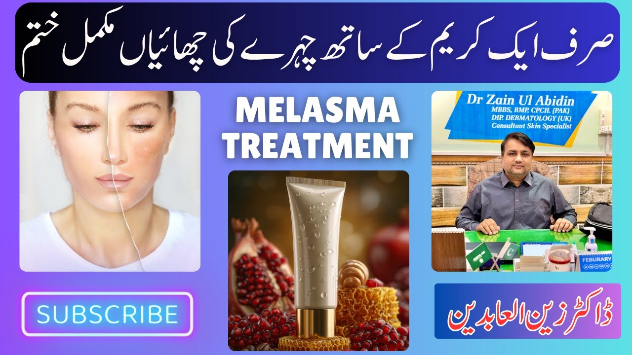 Chehre Ki Chaiyon Ka Gharelu Ilaj | Best Creams & Remedies for Melasma & Pigmentation