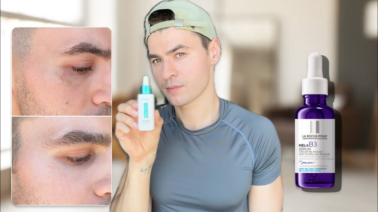 How I got rid of dark spots | Melasyl better than Hydroquinone  | L’Oreal Bright Reveal