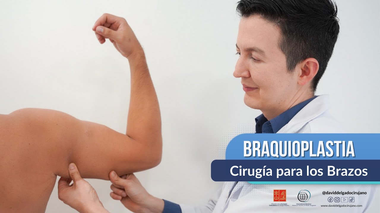 Braquioplastía Cirugía de Brazos | Cirugía plastica de brazos flácidos |