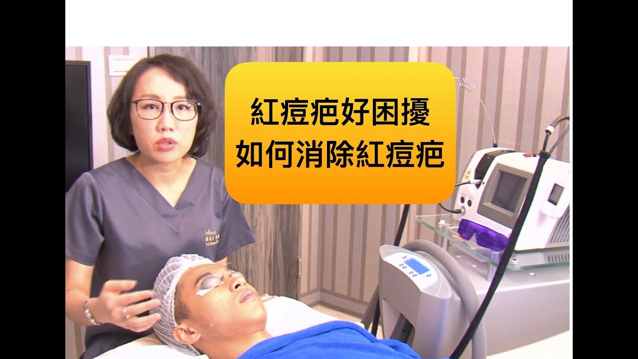 痘疤治療之紅痘疤好困擾，585二極體雷射幫你消除紅痘疤！