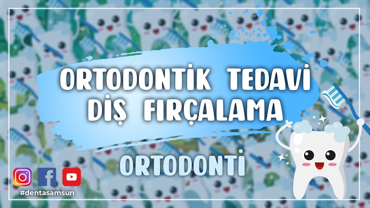DİŞ TELİ TEDAVİSİNDE DİŞ FIRÇALAMA NASIL YAPILIR?