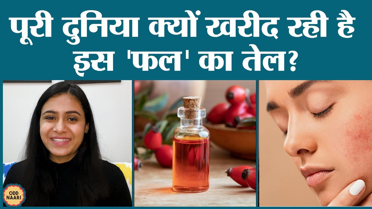 Rosehip oil benefits: पिंपल्स और कई दूसरी स्किन प्रोब्लेम्स का रामबाण इलाज है ये तेल