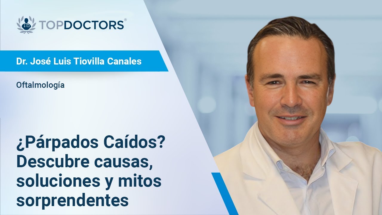 ¿Párpados Caídos? Descubre Causas, Soluciones y Mitos Sorprendentes