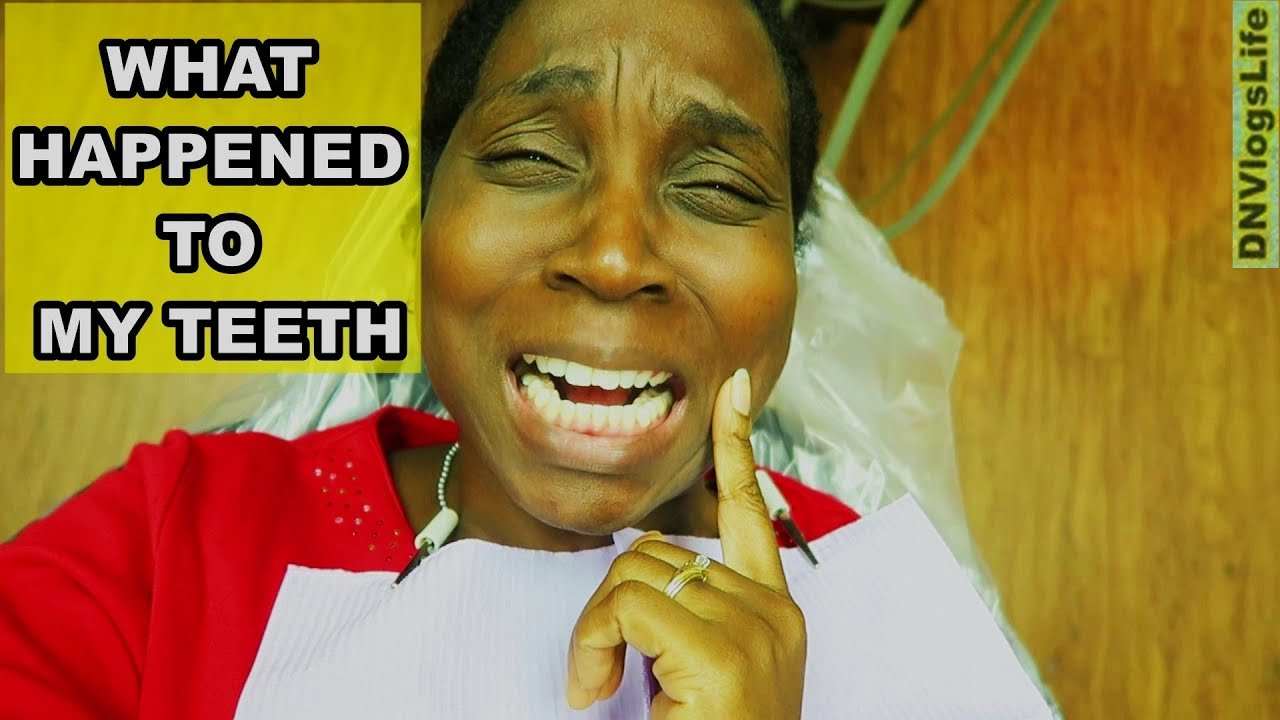 What Happened to My Teeth? Best Dentist in Houston Texas