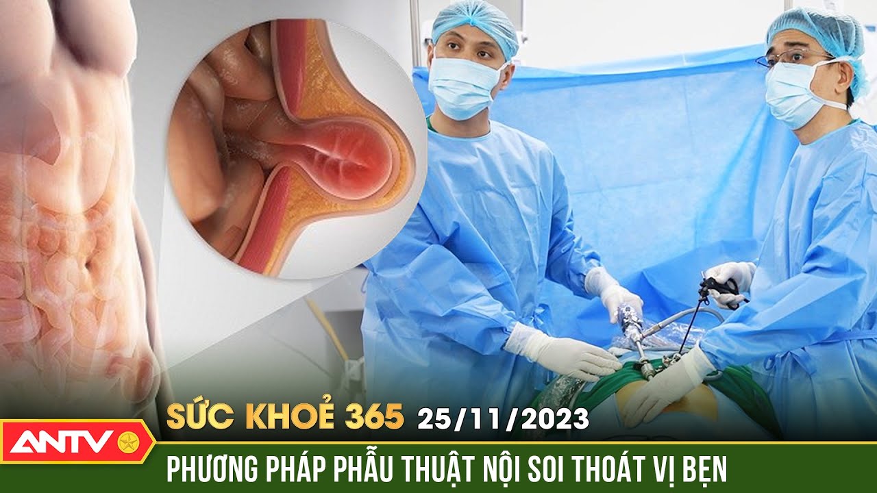 Phẫu thuật nội soi thoát vị bẹn và những điều người bệnh cần lưu ý | Sức khỏe 365 | ANTV