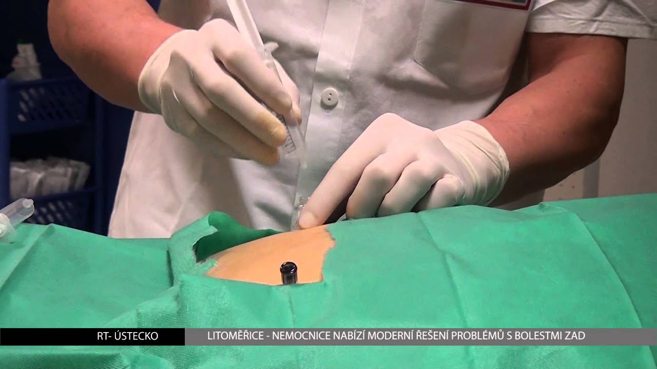 LITOMĚŘICE: Nemocnice nabízí moderní řešení problémů s bolestmi zad