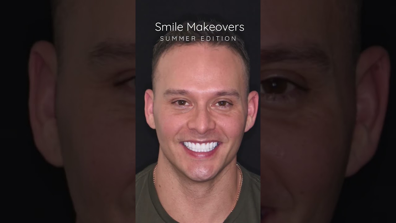 Before and After Porcelain Veneers by: cosmetic dentist Dr. Tejas Patel