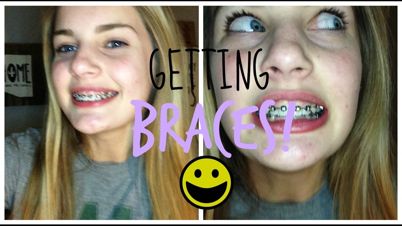 GETTING MY BRACES ON!