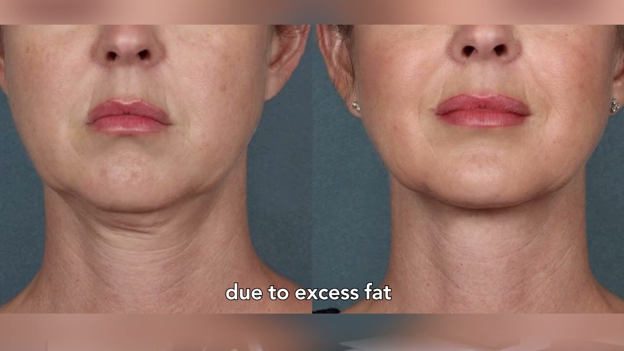 3 Procedures You Can Do at Our Clinic!