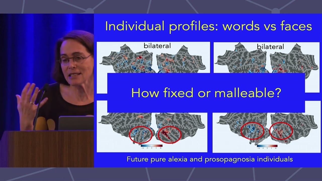 CNS 2023: Marlene Behrmann, PhD, 