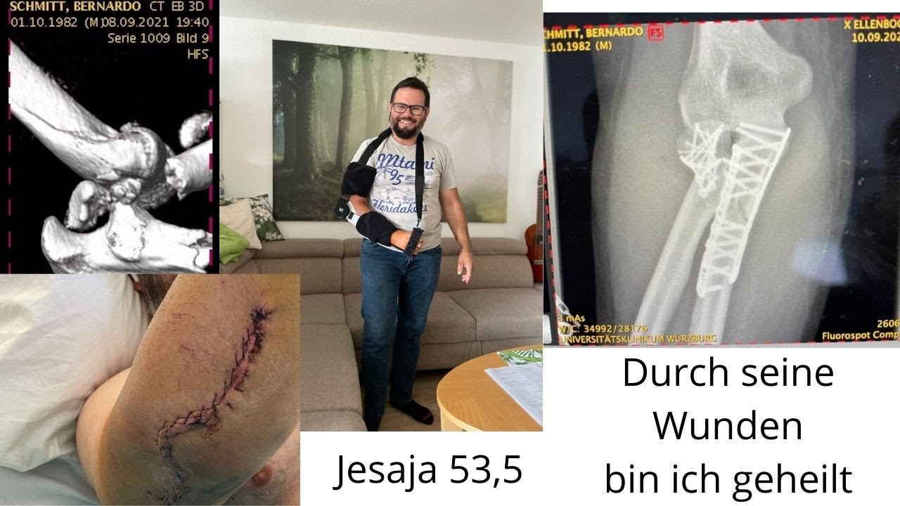 Unfall Bernardo | durch seine Wunden sind wir geheilt