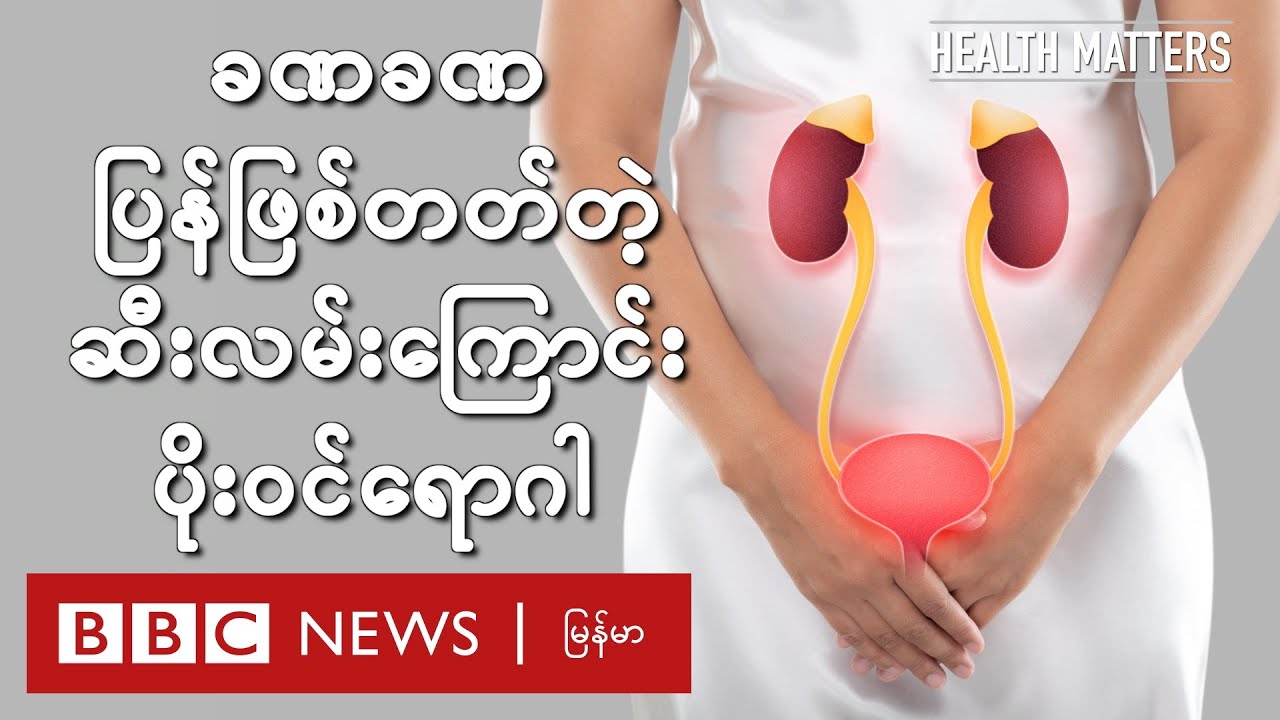 ခဏခဏ ပြန်ဖြစ်တတ်တဲ့ ဆီးလမ်းကြောင်းပိုးဝင်ရောဂါ - BBC News မြန်မာ