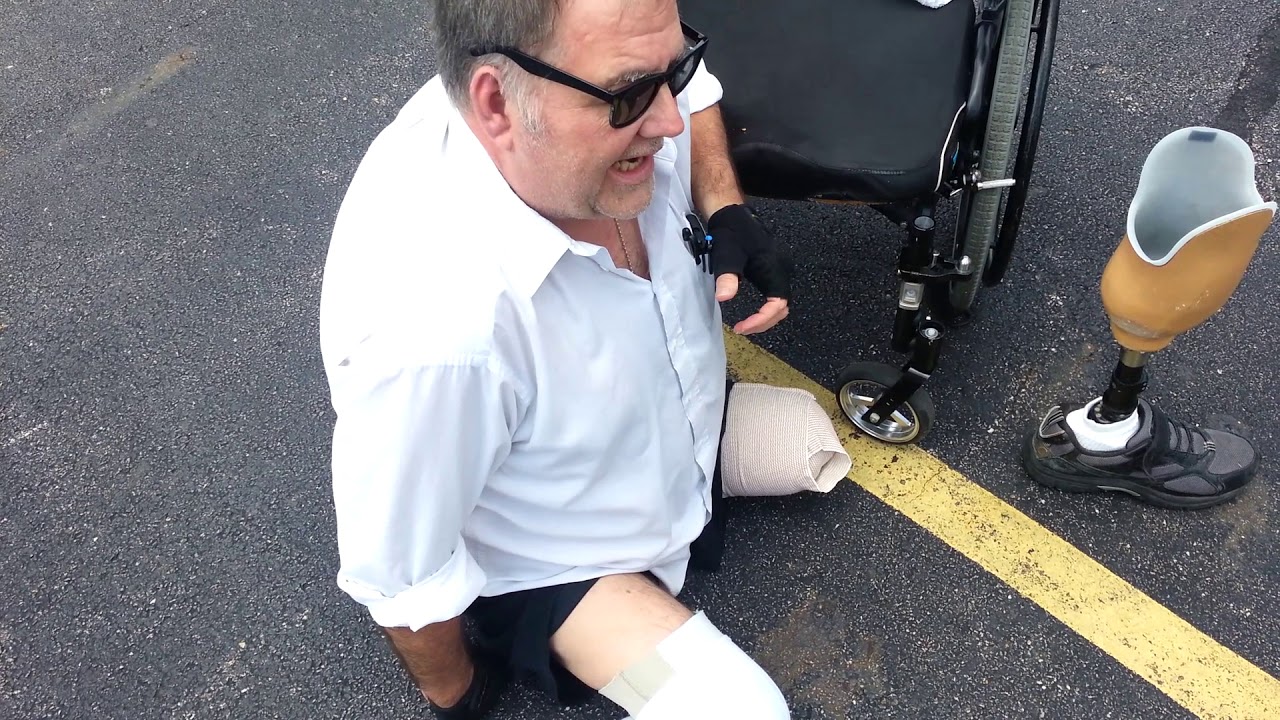 104 Flipped over in wheelchair-- How to recover--AKA BKA amputee