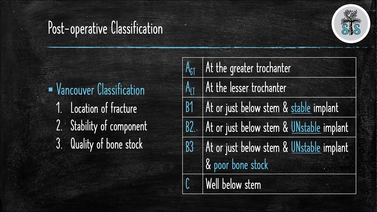 THA Periprosthetic Fractures