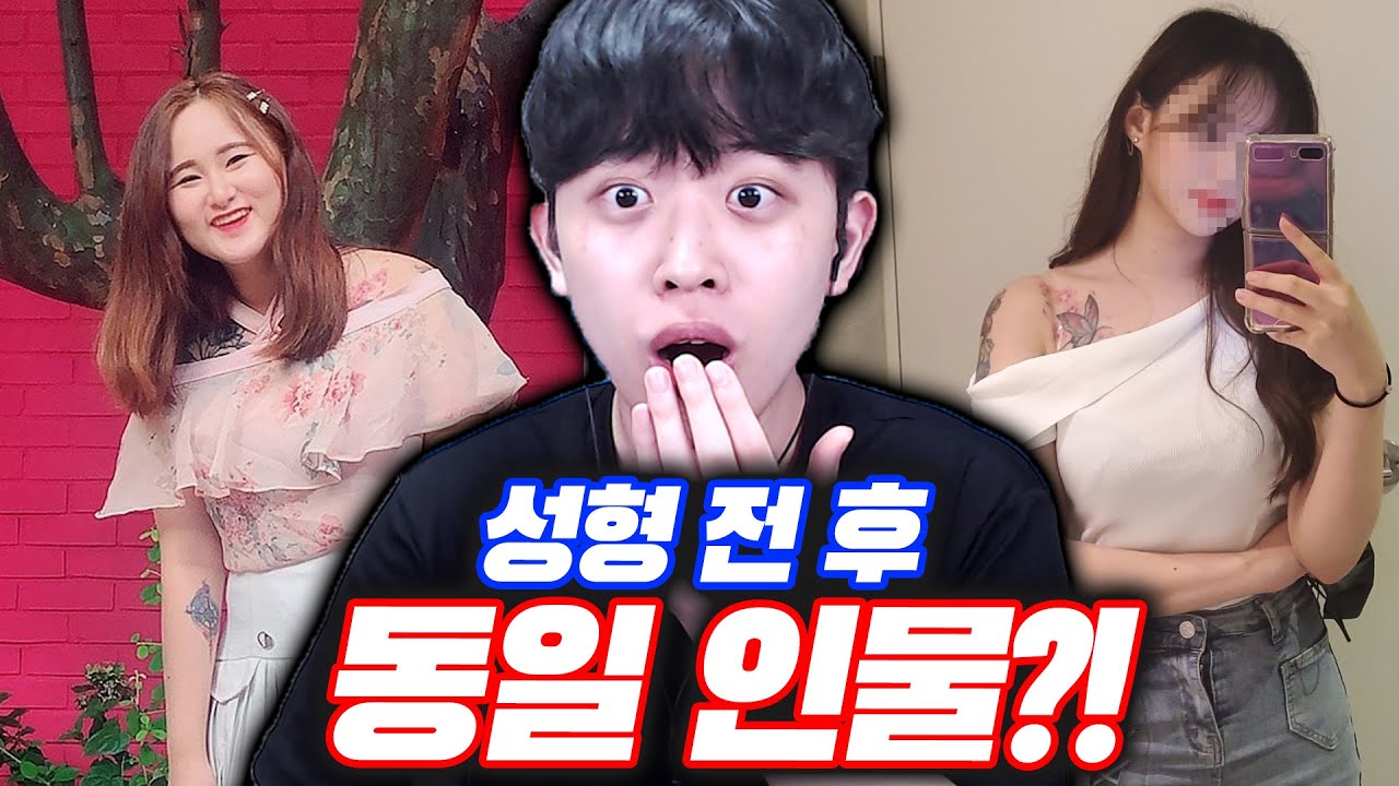 성형 전 후 반전 사진 대회ㄷㄷ