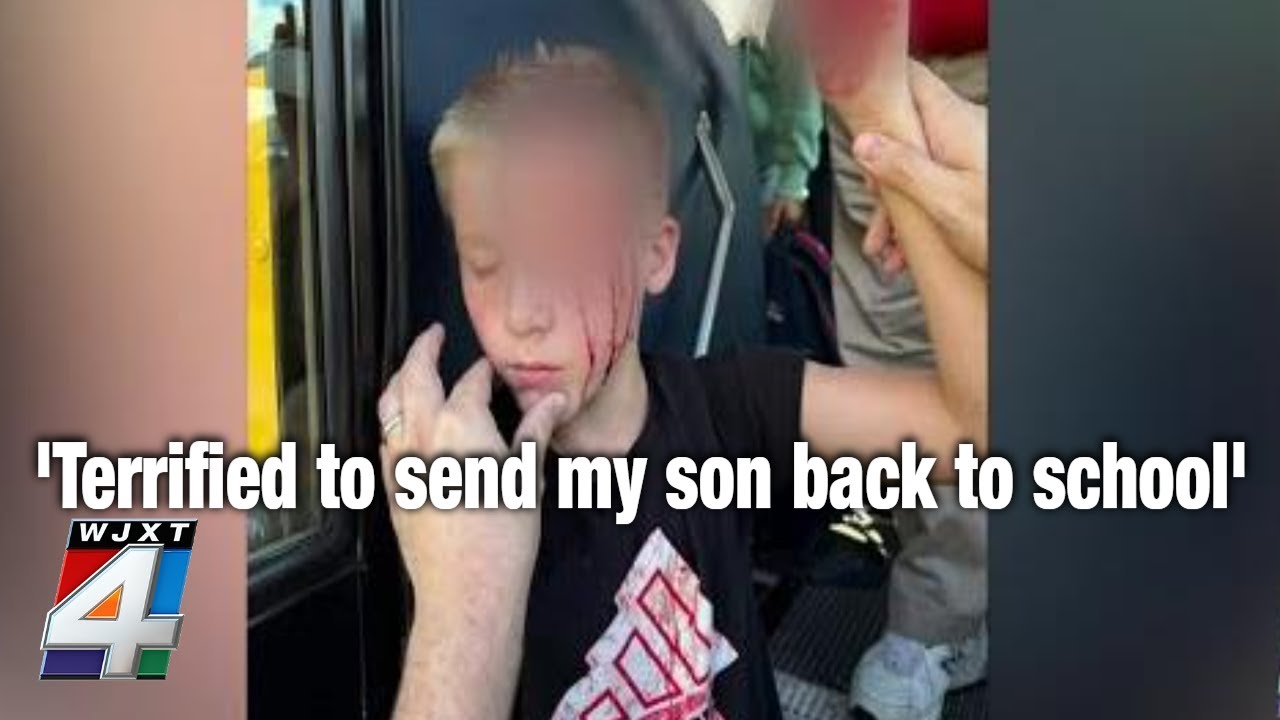 ‘Terrified to send my son back to school’: St. Johns County mom demands answers after son attacked