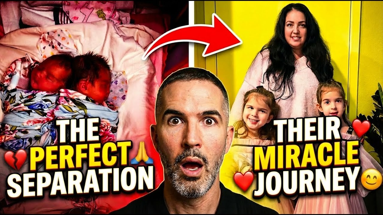 The Perfect Separation: The Story Doctors said was Impossible