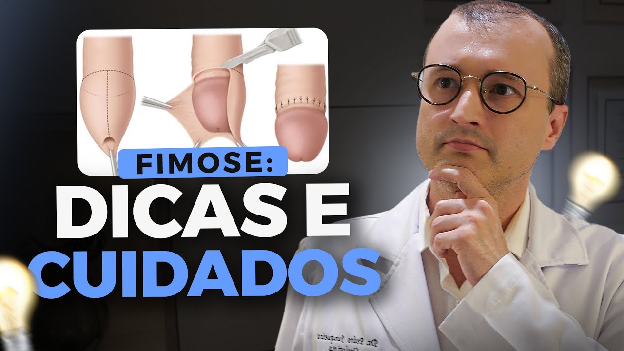 NÃO OPERE FIMOSE SEM VER ESSE VÍDEO! | Cirurgia de fimose