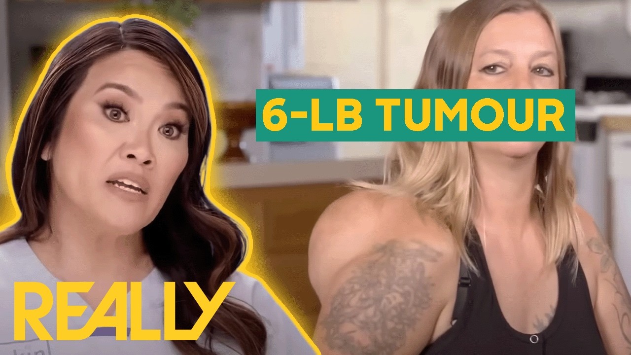 Dr. Lee Removes 6-lb Tumour From Woman&rsquo;s Shoulder Blade | Dr. Pimple Popper