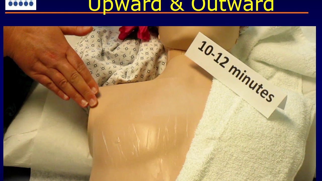 Breast Care After Radiotherapy: Massage Instructions